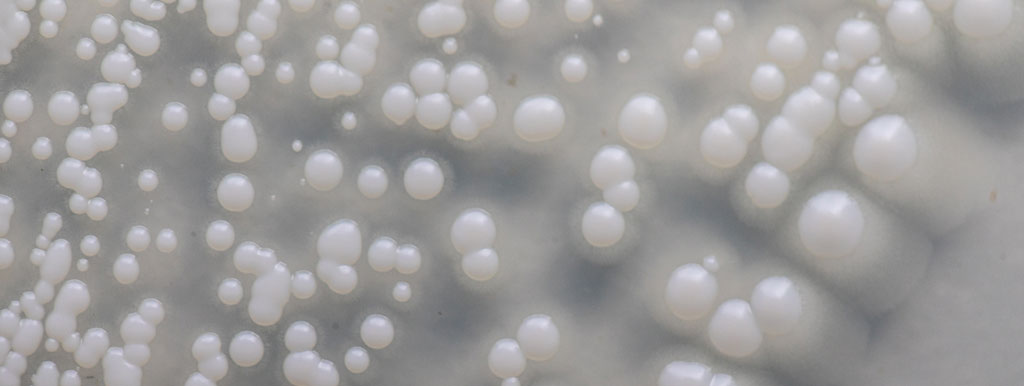 Bètaglucaan, een prebioticum, tegen pollenallergie