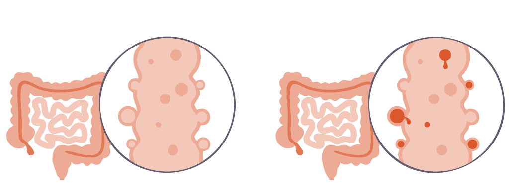 Mucuslaag van de darmen