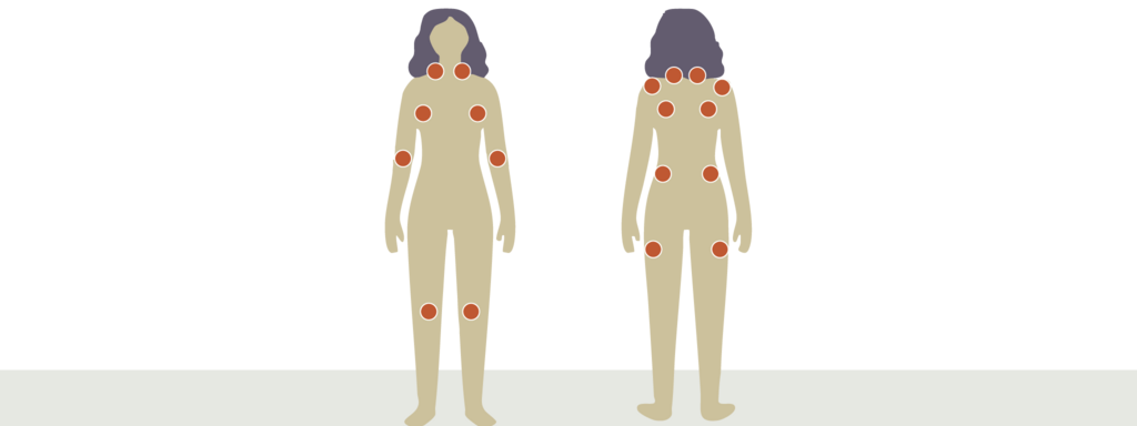 Cognitieve, fysieke en meditatieve training tegen fibromyalgie