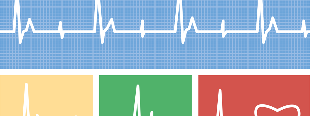 Homocysteïne als cardiovasculaire risicofactor Homocysteïne als cardiovasculaire risicofactor