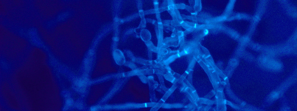 Bacillus subtilis natto Bacillus subtilis natto