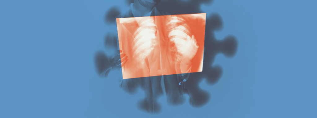Welke metabolisme schuilt achter long-covid?