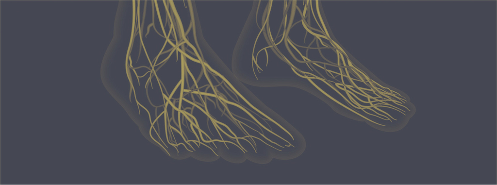 Neuropathie en voedingssupplementen Neuropathie en voedingssupplementen