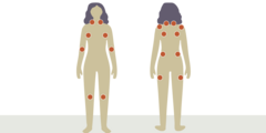 Cognitieve, fysieke en meditatieve training tegen fibromyalgie