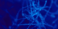 Bacillus subtilis natto