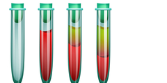 HbA1c diabetesdiagnose