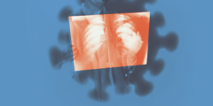 Welke metabolisme schuilt achter long-covid?