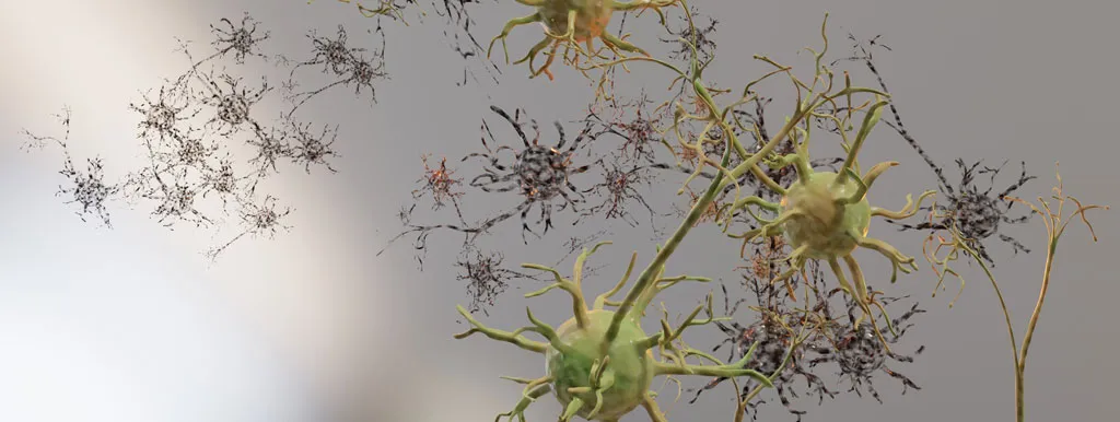 Koreaanse kruiden vertragen ALS