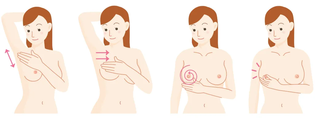 Jodium en borstkankerkans