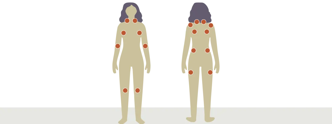 Cognitieve, fysieke en meditatieve training tegen fibromyalgie