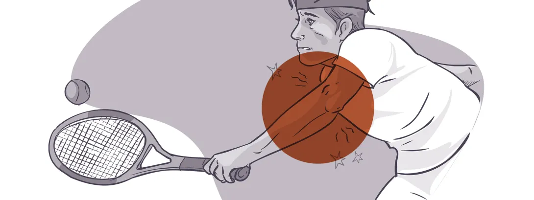 Sneller herstel tenniselleboog